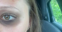Estate agent, 22, attacked at random by stranger in broad daylight after viewing
