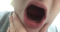 Mum, 24, has no teeth after losing them during horrific pregnancy sickness