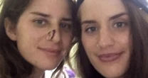 Brit twins savaged by crocodile smile in first pic together since horrifying attack