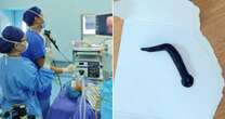 Boy having difficulty breathing coughs up a five-inch leech in front of horrified doctors