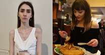 'Massive foodie' loses half her body weight due to rare condition stopping her eating