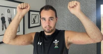 Brit tourist has 'unbearable' bed bug bites after France stay with huge red marks on skin