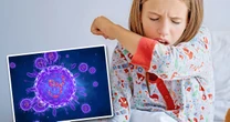 Croup symptoms and treatment for common condition with 'seal barking' coughNHS