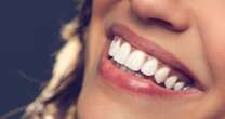 Dental experts' four DIY tips for straighter teeth as they warn against teeth filingTeeth