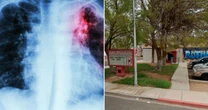 Victorian illness fears sweep across city after super-spreader visits multiple schools