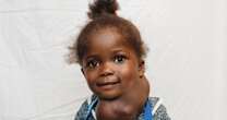 Girl, 3, has life saved after doctors remove neck tumour the size of her face