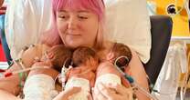 Birth injury left one triplet girl with just 10 per cent of her brain remainingTriplets