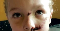 Boy, 6, hit by teen on scooter suffers fractured skull and is 'scared of his reflection'