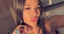 Teenager reveals she 'cooked her belly' after using a hot water bottle to combat crampsIBS