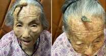 Woman, 107, credits 10cm horn growing out of her forehead with granting her long life