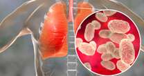 Britain to create the world’s first DNA test 'early warning system' for the next Disease X