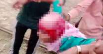 Schoolgirl's scalp is ripped off when her hair is caught in ferris wheel during fairground horror