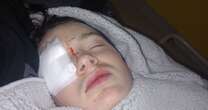 Schoolboy, 14, goes blind after rogue firework hit his eye while walking in the park