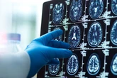 Tiny brain change that reveals if you are a 'cold-blooded killer' discovered