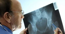 With 10 million waiting for surgery after Covid here's what you can do while you wait
