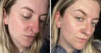 ‘This barrier-repairing spray fixed my dry skin - you can even wear it over makeup’