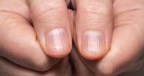 Harvard genetics professor shares what your fingernails say about your 'biological age'