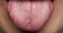 'Split-second tongue check' could unveil red flags of health issue, say experts