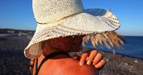 How to treat sunburn fast - and five things you should never do, according to NHS