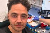 ITV Emmerdale's Adam Thomas only eating two things in bid to help 'draining' health condition