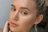 Molly Mae Hague diagnosed with health condition as fans rush to support her