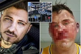 'Back off my Benidorm bouncers under attack from drunk Brits with broken bottles'