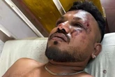 'Upset' family of Air India survivor says he has 'no idea' how he escaped as brother missing