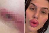 Model's breasts leaked green gunk and she nearly died after botched Turkey boob job