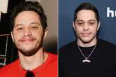 Pete Davidson almost unrecognisable as star removes iconic tattoos after rehab