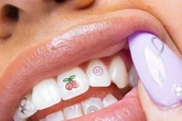 Are Tooth Tattoos the next 2025 trend? New fashion look sees engraved dental caps fitted to teeth for just £200