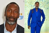 Strictly star Jimmy Floyd Hasselbaink says leg 'lucky' not to be amputated after freak injury