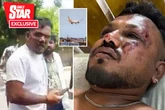 Air India survivor may feel pressure to live up to expectation of 'gift' he's been given