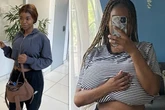 'Painful rare condition made my boobs grow five cup sizes'