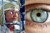 Risk of stroke could be discovered with a simple eye test and artificial intelligence