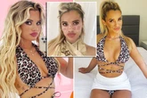 'I used a TikTok hack to get fake freckles but was left temporarily blinded and scarred'
