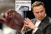 Elon Musk's brain chip implant set to give paralysed Brit patients 'mind control'