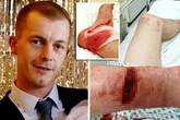 Man, 28, mauled by 'non-dangerous' pit bull as he cycled to work in 'appalling' attack