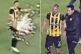 Footballer's testicle terror as firework hits privates with his own 'sorry' fans to blame