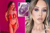 Babestation model 'nearly died' after BBL – and got huge tattoo to cover scars