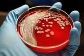 AI-designed antibiotics could kill drug-resistant superbugs such as gonorrhoea and MRSA