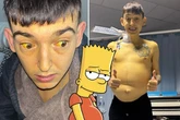 Bloke who turned Bart Simpson yellow due to health issue scared to leave home