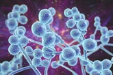 Warning as 'threat to humanity' fungal infection kills one in three people affected