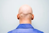 Balding blokes rejoice as salmon sperm injections set to 'boost' hair growth
