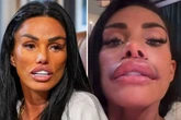 Katie Price shows off swollen face after latest surgery and complains about 'wonky' nose