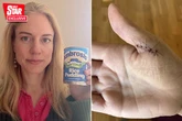 Doctor nearly dies in kitchen bloodbath after severing artery on tin of rice pudding