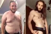 Costa manager left with 'melted' body due to loose skin after 14st weight loss