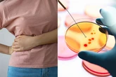 WHO warning issued over disease that turns skin yellow and blows liver up