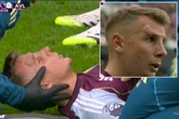 Prem star suffers gruesome injury after being kicked in the head by his own teammate