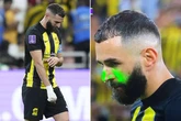 Karim Benzema gets laser in eye and misses penalty as Al-Ittihad lose at Club World Cup