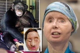 Woman's horror injuries as pet chimp rips off her face and hands and starts eating her eyes